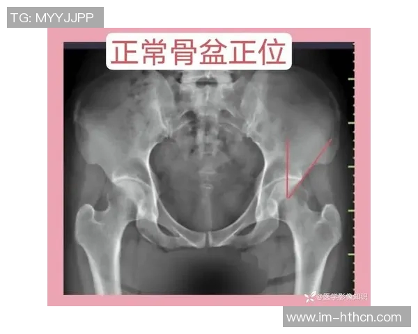 医生解析耻骨炎对亚马尔的影响及其过度使用损伤的成因与后果